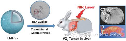 纳米材料与临床技术的结合：薄层状二硫化钼中空纳米球光热治疗原位肝脏肿瘤