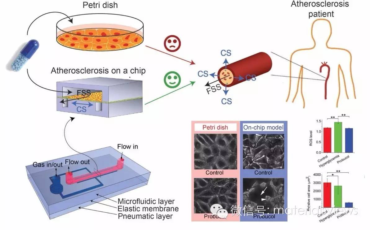 血管微环境模拟芯片：动脉粥样硬化研究的利器